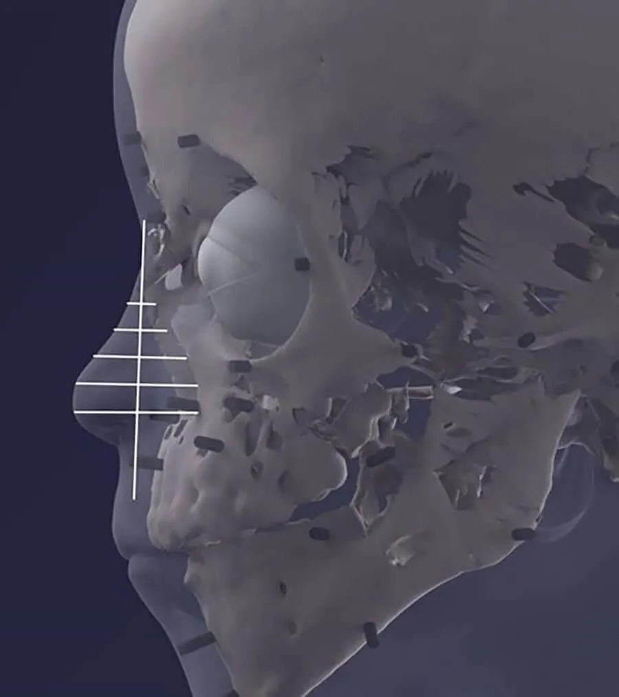 Egyptian boy’s facial reconstruction